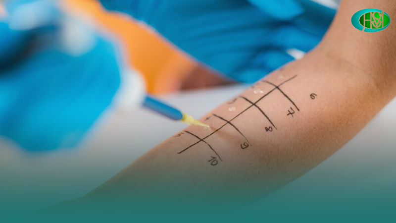 7-نکته-مهم-قبل-از-انجام-تست-پوستی